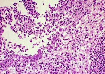 FIP-infected kidney showing inflammatory response